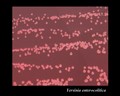 yersinia enterocolitica